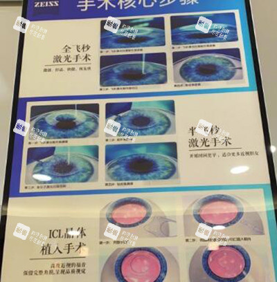 重庆佰视佳眼科医院飞秒手术