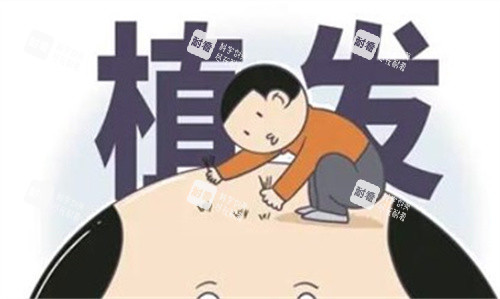 植发卡通图