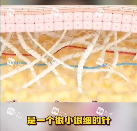 私密紧致针好不好