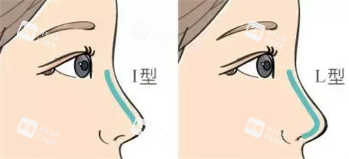 隆鼻不同形态假体呈现图