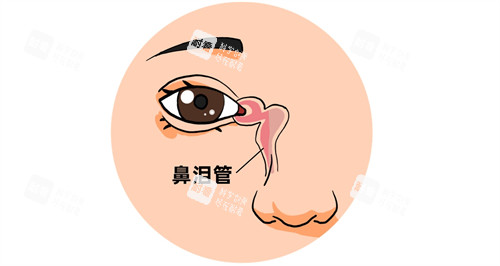 泪道阻塞常规堵塞的位置
