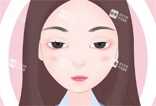 上眼睑下垂1