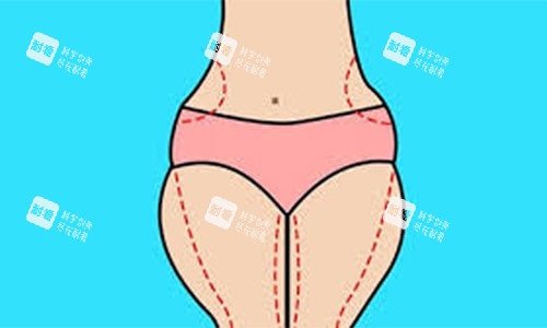 大腿吸脂手术设计方案示意图