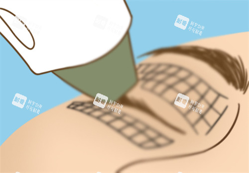 眼部热玛吉