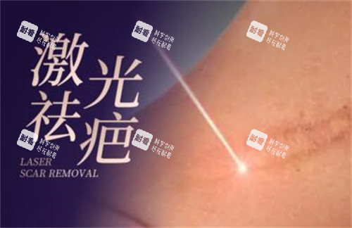 激光祛疤改善照片