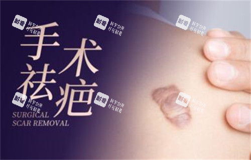 手术疤痕祛除改善图