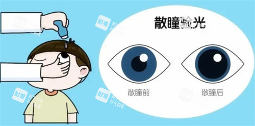 散瞳验光过程图解
