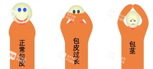 包皮过长、包茎、正常