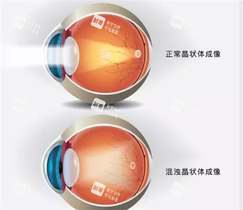 晶体表现图