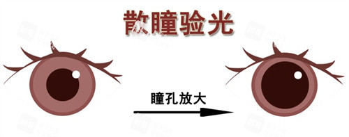 散瞳验光