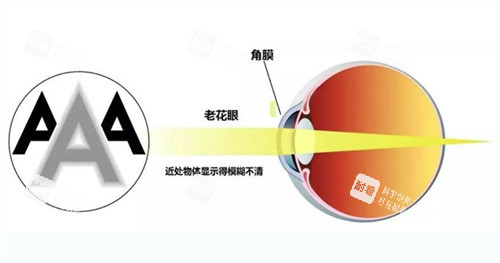 老花眼的眼睛