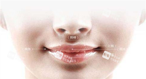 人中窝卡通图