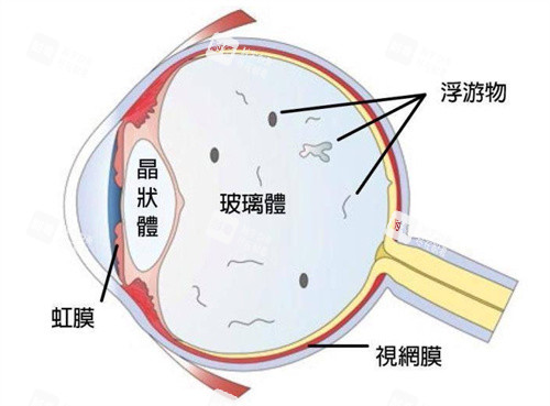 玻璃体图示