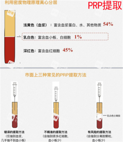 丽芙莎高潮针的原理介绍