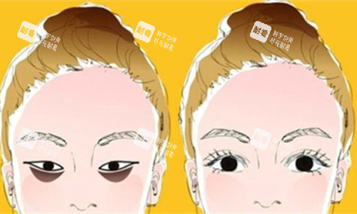 眼袋明显对比图