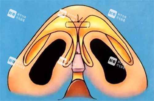 鼻头透视动画展示图