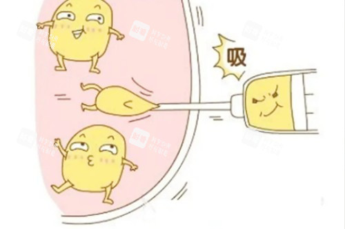 吸脂卡通图