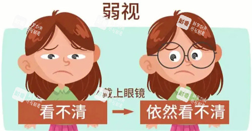 弱视眼睛视线