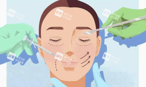双眼皮手术操作示意图