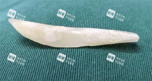 隆鼻假体图片