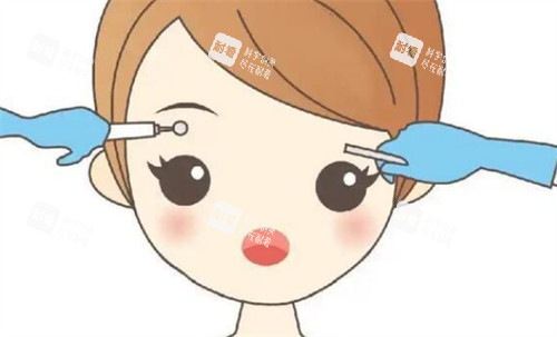 纹眉前后对比
