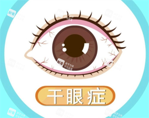干眼症照片