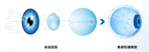 全光塑治疗模型