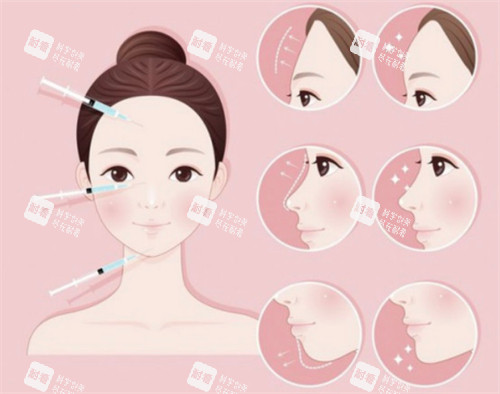 鼻基底凹陷可以用填充方式改善