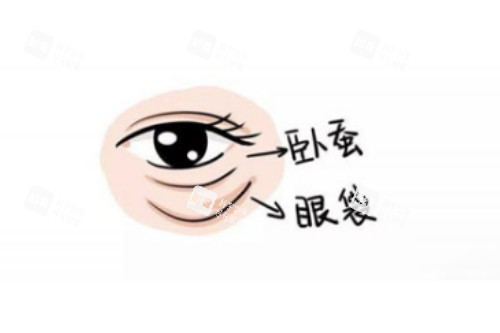 卧蚕、眼袋区别图