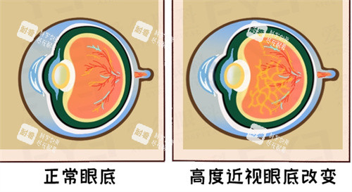 眼底视力呈现