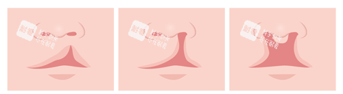 唇裂图