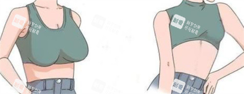 巨乳缩小