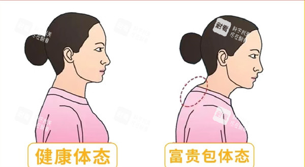 富贵包手术