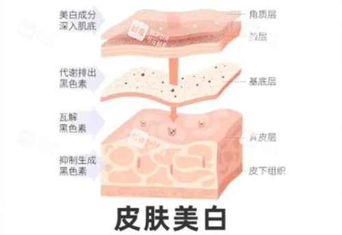 皮肤美白