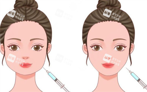 注射前后对比