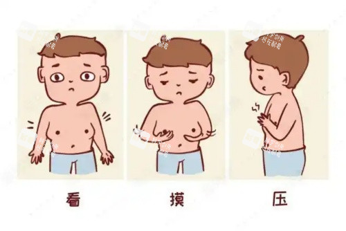 男性乳房发育吸脂前后对比图 男性乳房发育吸脂前后对比图