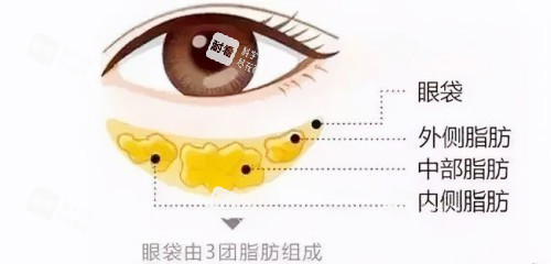眼袋图示