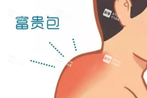 富贵包卡通展示图