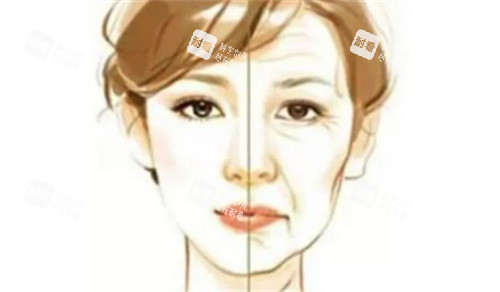 拉皮前后对比