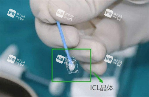 ICL晶体植入手术宣传