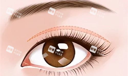 双眼皮特写展示图