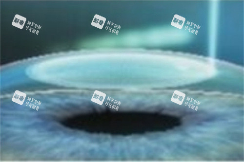 全飞秒激光