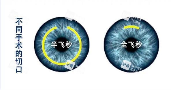 半飞秒和全飞秒区别