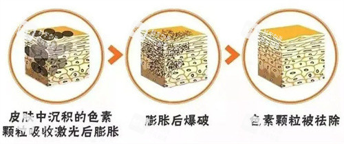 超皮秒原理