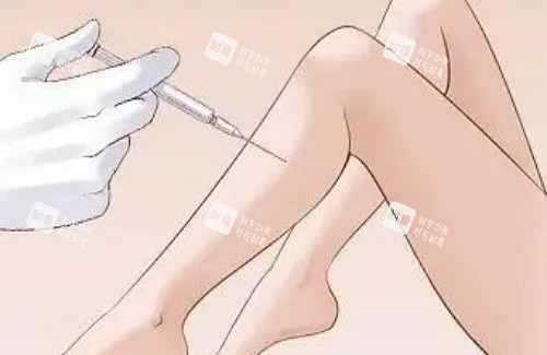 注射瘦腿示意图