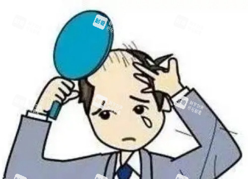 头发秃顶示意图
