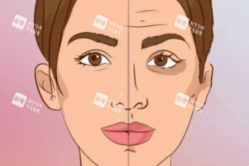 脸部做针剂提升卡通图