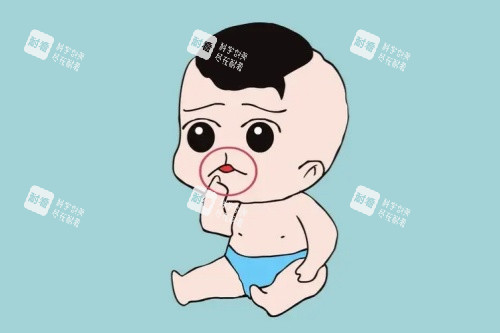 唇裂卡通图