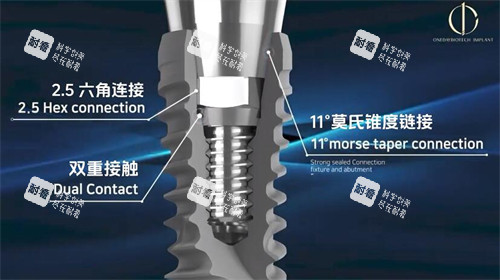 韩一种植牙材料展示照片 韩一种植牙材料展示照片