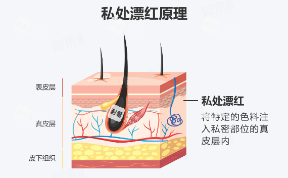 阴唇漂红原理